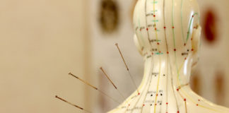 acupuncture and opioid addiction